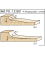 Mono-function cutter head series: Spare parts - Ref. ZAK527501 - 